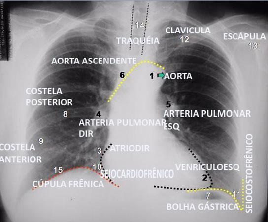 Imagem da questão 22 - radiografia de tórax